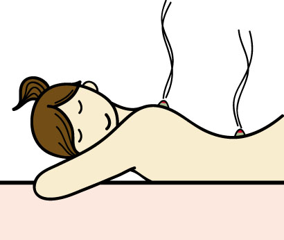 鍼灸治療の様子